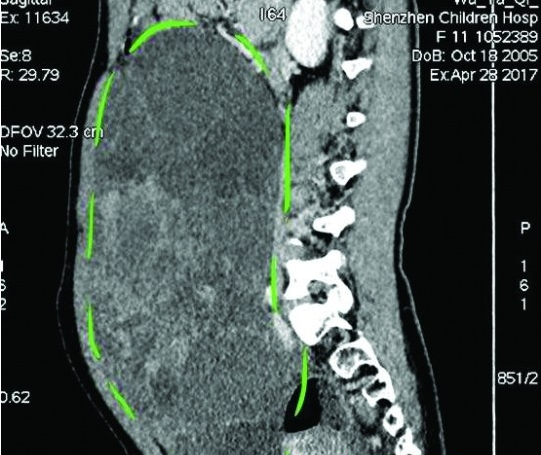 CT ͼ